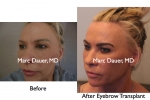 Before and After Eyebrow and Eyelashes Photos