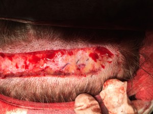 This shows the nylon suture retained in the tissue below the skin and the scarring.