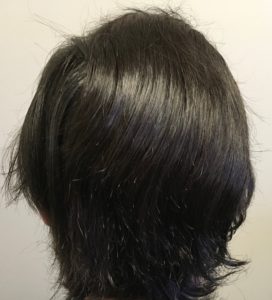 This is a photo of the "long hair FUE" process in a patient showing his donor region immediately post procedure with his hair wet and combed down.